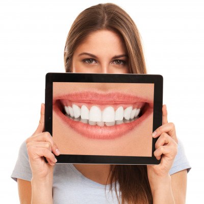 Imagen de ✨ Estética dental en Castellón: tu mejor sonrisa, ahora más cerca